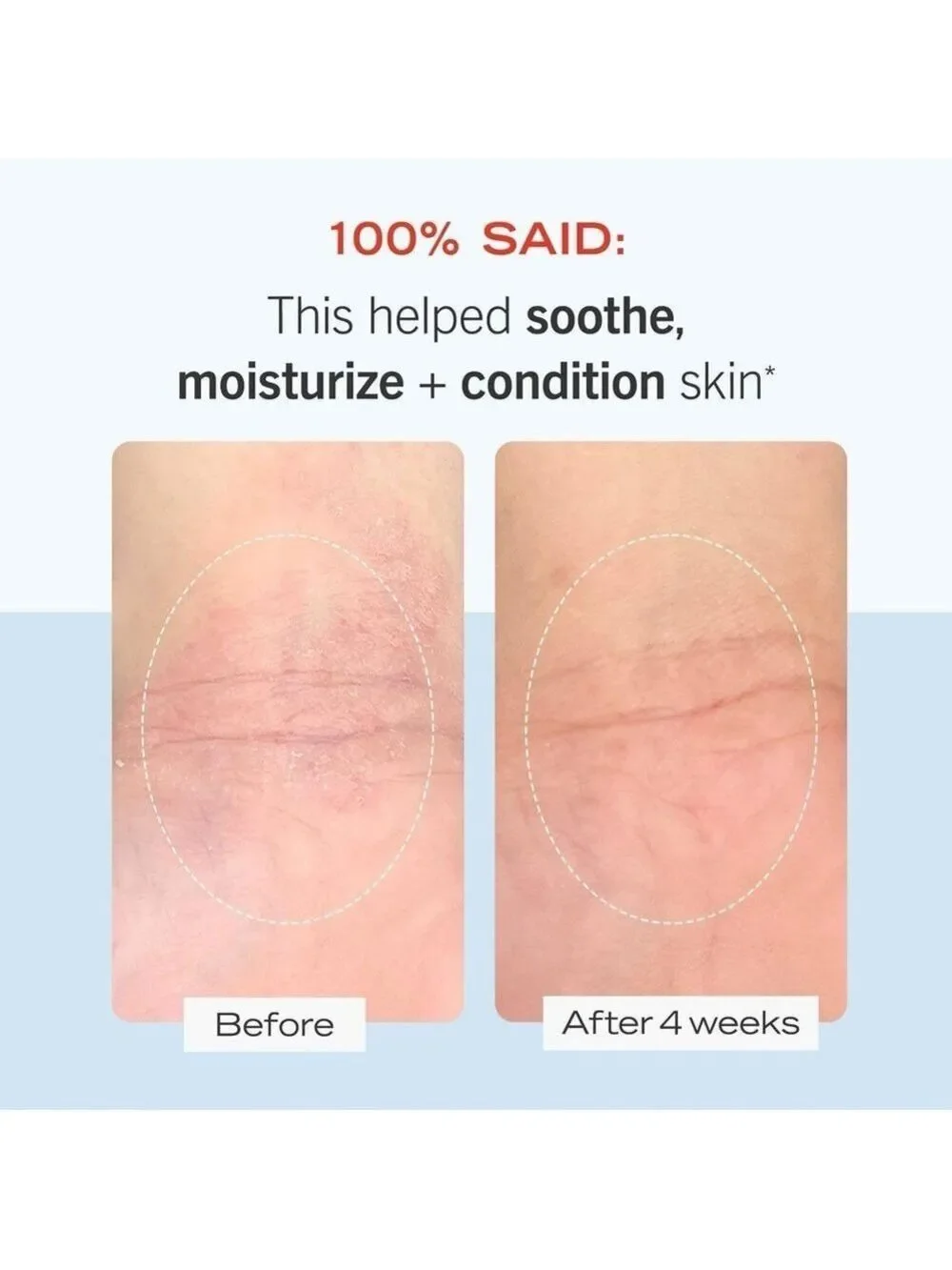FAB Ultra Repair Cream | NEW | First Aid Beauty | Full Size | Colloidal Oatmeal